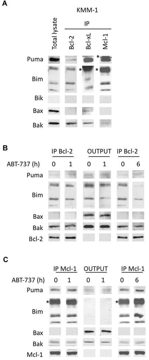Figure 7. Analysis of the dynamics of anti and proapoptotic Bcl-2 protein complexes in KMM-1 resistant cells treated by ABT-737. (A) Immunoprecipitation of KMM-1 cell lysates using the indicated antibodies. (B) Bcl-2 immunoprecipitation of KMM-1 cell lysates (300 μg) treated or not with 40nM ABT-737 for both 1 and 6 hours. The immunoprecipitates and the outputs (IP supernatants) were analyzed for the presence for the indicated proteins by immunoblotting. (C) Supernatants of Bcl-2 immunoprecipitation (300 μg) were used for Mcl-1 immunoprecipitation. Immunoblotting was preformed as described. The asterisk (*) corresponds to the immunoglobulin light chain.