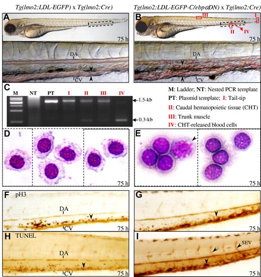 Figure 2. Circulation congestion and erythropoietic dysplasia in the C/ebpαDN transgenic embryos. (A-B) External features of the Tg(lmo2:LDL-EGFP) (A) and Tg(lmo2:LDL-EGFP-C/ebpαDN) (B) embryos at 75 hpf. The circulation congestion is only detected in the C/ebpαDN-expressing embryos (B, arrowheads and supplemental Videos 1 and 2). Black boxes with dashed lines indicate the regions amplified at the bottom. Red boxes and curved arrow indicate the sites where tissue or circulating cells were isolated and genomic DNA were extracted for genotyping shown in panel C. DA indicates dorsal aorta; and CV, caudal vein. (C) Analyses of Cre-mediated genomic recombination by genomic-nested PCR using 2 pairs of primers indicated at the bottom of Figure 1C. The Roman numerals indicate the anatomic sites where tissues and cells are dissected (I-III) or released from the CHT (IV). (D-E) Wright-Giemsa stainings and morphologic characterizations of circulating blood cells released from the CHT of transgenic embryos at 75 hpf from Tg(lmo2:LDL-EGFP). (D) All 3 panels are adopted from the same slide and composited together and Tg(lmo2:LDL-EGFP-C/ebpαDN). (E) Both panels are adopted from the same slide. Arrow indicates the cell undergoing mitosis. Images were acquired with a 100× oil objective. (F-I) Proliferation and apoptosis analyses by pH3 immunochemistry stainings (F-G) and TUNEL assays (H-I) in the embryos expressing EGFP and EGFP-C/ebpαDN at 75 hpf as described in “Immunochemistry and TUNEL assays.”
