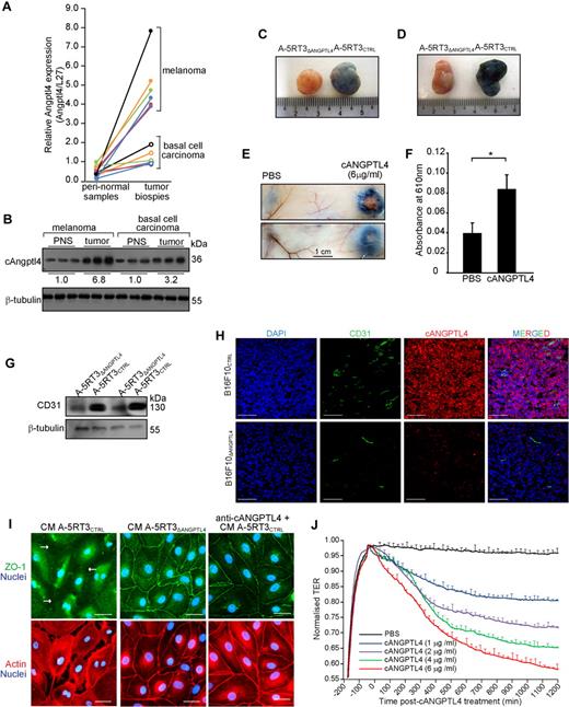 Figure 1. cANGPTL4 is elevated in metastatic tumors and disrupts endothelial junction integrity. (A-B) Expression levels of cANGPTL4 mRNA (A) and protein (B) in basal cell carcinoma (BCCs) and metastatic melanoma paired with peritumor normal tissues as determined by quantitative real-time PCR and immunoblot, respectively (n = 3). Data spots from same individual are linked by colored lines. Ribosomal protein L27 (L27) was used as a reference housekeeping gene. β-tubulin served as a loading and transfer control. (C-D) Evans blue dye extravasation induced by either A-5RT3CTRL– or A-5RT3ΔANGPTL4–induced tumors of different (C) or similar (D) tumor volume (A-5RT3CTRL, 1098 ± 422 mm3 vs A-5RT3ΔANGPTL4, 551 ± 135 mm3; P < .05; n = 6). (E-F) Evans blue dye extravasation induced by cANGPTL4 or PBS vehicle (G) and quantification (H) of extravasated Evans blue dye by measurement of absorbance at 610 nm. *P < .05. (G) Immunodetection of CD31 in A-5RT3CTRL– and A-5RT3ΔANGPTL4–induced tumors. (H) Immunofluorescence staining for CD31 and cANGPTL4 in B16F10CTRL- and B16F10ΔANGPTL4-induced tumors. Scale bar represents 100 μm. (I) Immunofluorescence staining for ZO-1 in a confluent HMVEC monolayer. Cells were treated with either CM from A-5RT3CTRL in the presence or absence of anti-cANGPTL4, from A-5RT3ΔANGPTL4 cells. HMVECs were counterstained with DAPI (blue) for nuclei and phalloidin (red) for actin stress fibers. Scale bar represents 40 μm. White arrows indicate endothelial junction lesions. (J) Transendothelial electrical resistance (TER) analysis of confluent monolayer HMVECs treated with the indicated amounts of cANGPTL4. PBS served as a vehicle control. Data (means ± SD) from 3 independent experiments.