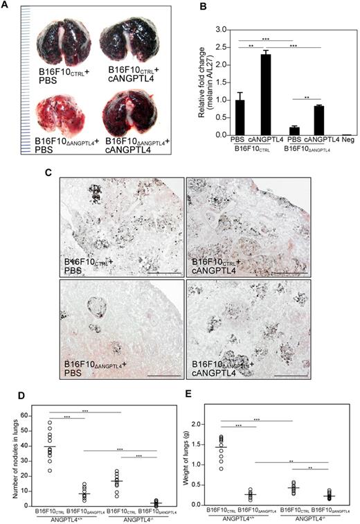 Figure 7. cANGPTL4 facilitates metastasis. (A-C) Representative macroscopic images of lungs (A); relative expression of melanin A (B); and representative eosin-stained images of lung sections (C). Black nodules in panel C indicate intravasated melanoma (n = 5). Micrographs of lung sections were taken with MIRAX MIDI (Carl Zeiss) with a Plan-Apochromatic 20×/0.8 objective and MIRAX Scan software. Scale bar: represents 100 μm. (D-E) Number of nodules (D) and weights of lungs (E) from wild-type and ANGPTL4-knockout C57BL/6J mice intravenously injected with either 5 × 105 B16F10CTRL or B16F10ΔANGPTL4 cells (n = 12). **P < .01; ***P < .001.