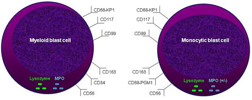 Figure 2. Immunophenotypic profile of EM myeloid leukemia. A panel of immunohistochemical markers may be useful in establishing the diagnosis of MS or LC. Myeloid (A) and monocytic (B) blast cells can express variable immunophenotypes, which may aid in their distinction.