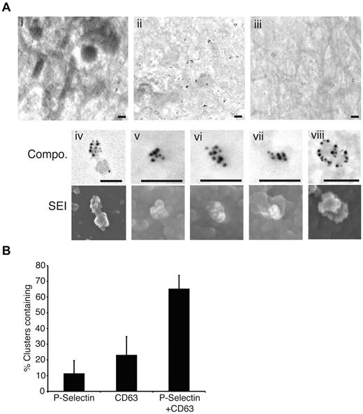 Figure 4. Cell surface clustering of P-selectin and CD63 in stimulated HUVECs. (A) IL-4 treated HUVECs were grown to a confluent monolayer and stimulated with PMA followed by fixation. Coverslips were labeled with primary antibodies followed by secondaries conjugated to colloidal gold particles. Samples were then processed for scanning EM and distribution of gold particles analyzed. Labeling for P-selectin (10 nm gold) and CD63 (15 nm gold) shows a tendency of the 2 proteins to co-cluster. Panels i-iii show 3 example backscatter images of the gold labeling of P-selectin and CD63. Magnifications of example clusters are shown in panels iv-viii with gold particles shown in backscatter images (compo) and corresponding surface structures shown in secondary electron images (SEI). All scale bars represent 200 nm. (B) Quantification of scanning EM clusters, showing the percentage of clusters observed containing P-selectin, CD63 or both molecules together. Data were obtained from 5-10 separate low power images of equal magnification from 4 independent experiments. A total of 538 and 994 gold particles were counted for P-selectin and CD63 labeling, respectively. Data are shown as mean ± SD.
