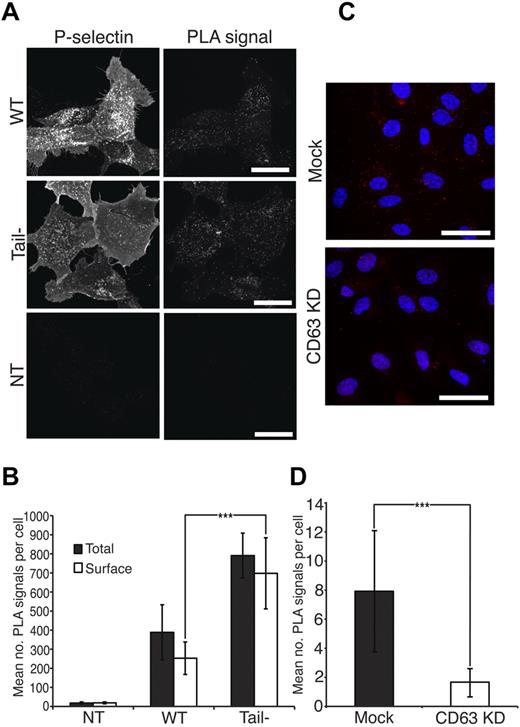 Figure 5. Proximity ligation assay (PLA) demonstrates P-selectin and CD63 interactions. (A) After fixation and blocking, HEK 293 cells transfected with wild-type P-selectin, tail-deficient mutant P-selectin or nontransfected (NT) cells were assayed for CD63-P–selectin interactions (surface and total) using the Duo-link II Probemaker kit after the manufacturers instructions. PLA signals and P-selectin expression levels were then detected using confocal microscopy. Images show representative confocal maximal projections of surface PLA signals and P-selectin. Scale bars represent 25 μm. (B) The mean number of surface and total PLA signals per cell were quantified using Volocity Version 5.3.1 software and this value was normalized according to the level of P-selectin expression in each cell. A total of 8-10 cells were analyzed for each condition. (C) CD63 siRNA or mock treated HUVECs were PMA-stimulated followed by fixation and blocking. Endothelial surface CD63–P-selectin interactions were assayed the same way. Images show representative confocal maximal projections with PLA signals in red and nuclei in blue. Scale bars represent 25 μm. (D) Quantification of panel C. Images were quantified by counting total number of PLA signals in each image and dividing by the number of nuclei in field of view. A total of 286 and 471 individual cells were counted for mock and CD63 KD samples, respectively taken from 3 independent experiments. ***P < .001 by Student t test. Data are shown as mean ± SD.