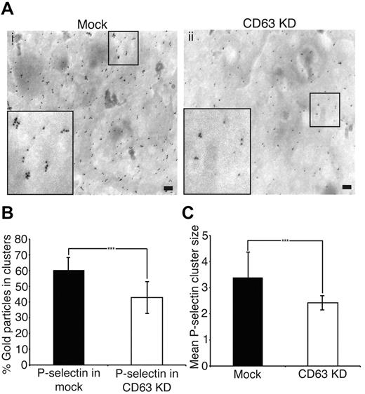 Figure 6. Cell surface P-Selectin clustering is reduced in CD63-depleted HUVECs. HUVECS, mock-treated or treated with 2 rounds of siRNA against CD63, were grown to a confluent monolayer. Cells were PMA-stimulated and fixed then coverslips labeled with primary antibodies against P-selectin followed by secondary antibodies conjugated to colloidal gold particles. Samples were then processed for scanning EM and distribution of gold particles then quantified. Scale bars represent 200 nm. (A) General views of cell surfaces indicating distribution of P-selectin. Large inserts are magnifications of the smaller boxes. Quantification reveals a reduction in the percentage of P-selectin found in clusters (B) and a reduction in the mean cluster size (C) after loss of CD63. Data were obtained from 5-10 separate low power images for each condition across 4 independent experiments. (B-C) ***P < .001 by Student t test. Data are shown as mean ± SD.