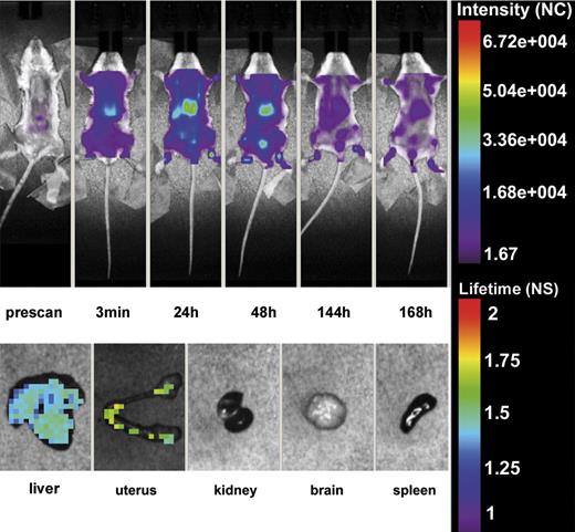 Figure 1. In vivo distribution of β2GPI-Cy5.5. Top panel: Whole body scan of one representative mouse of 4 that received β2GPI-Cy5.5 (50 μg) into the tail vein by Time-Domain Optical Imaging. The distribution of the labeled protein was followed at various time intervals for one week. The signal was rapidly detected in the liver after injection where persisted for 48 hours and was progressively seen in the bladder. The distribution pattern was similar in all treated animals. Bottom panel: Ex vivo imaging of organs isolated from a representative mouse killed one week after injection of β2GPI-Cy5.5 and analyzed by eXplore Optix. Note the presence of the signal in the liver and the uterus. All animals showed a similar organ distribution.