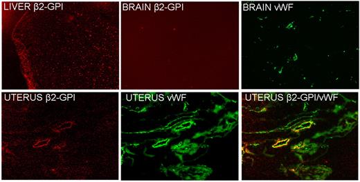 Figure 2. Detection of β2GPI-Cy5.5 in sections of different tissues by atomic force microscope. Note the absence of the signal in the brain and the different distribution patterns in the liver (granular) and in the uterus, where is colocalized on the vascular endothelium with VWF, a marker of ECs. Original magnification 100×.