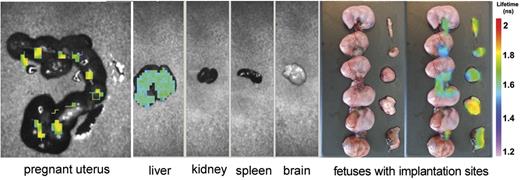 Figure 3. Analysis of the uterus and other organs isolated from 1 representative pregnant mouse of 4 one week after injection of β2GPI-Cy5.5 by eXplore Optix. The signal is visible in the pregnant uterus and in the liver. Note that the signal in the uterus is detected at the implantation sites and umbilical cords while absent in the fetuses. The distribution pattern was similar in all treated animals.