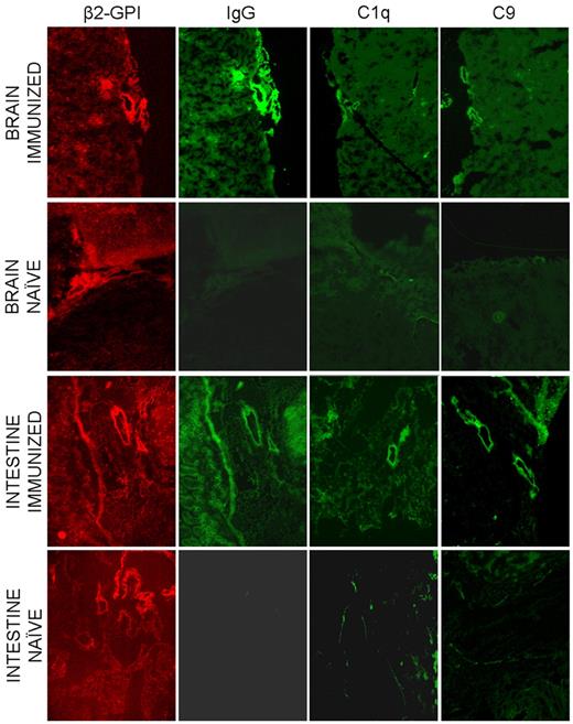 Figure 6. Distribution of β2GPI-Cy5.5, IgG and the C components C1q and C9 on various tissues collected from LPS treated mice 4 hours after injection of the labeled protein. The same sections were analyzed for the presence of β2GPI-Cy5.5 and for the deposition of IgG and C components by the atomic force microscope. Original magnification 100×.