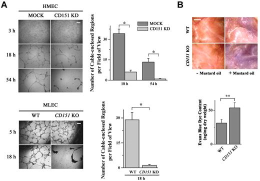 Figure 1. CD151 reinforces vascular stability and regulates vascular permeability. (A) Loss of CD151 expression disrupted EC capillary-like structures on Matrigel. HMEC-MOCK and -CD151 KD (top) or MLEC-WT and -CD151 KO (bottom) cells were plated on Matrigel and photographed with an Olympus CK2 inverted microscope under a 4×/0.10 NA objective equipped with a microscope digital camera (DCM500) at the indicated time points. The cable-enclosed regions were counted and compared. Bar represents 250 μm. *P < .01. (B) CD151 ablation results in increased vascular permeability in mice. Evans blue dye (30 mg/kg in PBS) was injected intravenously through the retro-orbital sinus into 12-week-old male mice. Mustard oil in mineral oil (5% volume/volume) or mineral oil alone was applied to the dorsal and ventral surfaces of the ears twice, at 0 minutes and 15 minutes later. After 30 minutes of circulation, the dye leakage area at the ventral surface of the ear was imaged with a Nikon SMZ1500 dissecting microscope equipped with a Nikon DXM1200 digital camera and the content of dye in ears was determined after the extraction with formamide overnight at 55°C. Shown are representative images (top) and quantitative results from WT and CD151 KO mice from the Miles assay. n = 15. Bar represents 1 mm. **P < .05.