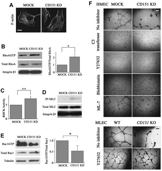 Figure 4. CD151 silencing deregulates RhoA and Rac1 signaling. (A) Loss of CD151 expression results in increased stress fiber formation. After spreading overnight, HMEC transductants were stained with AlexaFluor-488-conjugated phalloidin. F-actin staining was visualized with a Zeiss LSM510 confocal fluorescence microscope under a 100×/1.4 NA oil objective. Bar represents 10 μm. (B) HMEC transductants were seeded in diluted Matrigel-coated dishes and cultured overnight. Cell lysates were incubated with glutathione-S-transferase-Rhotekin Rho-binding domain beads to pull down GTP-bound RhoA. RhoA levels in pull-down precipitates, and whole-cell lysates were determined by SDS-PAGE and immunoblotting using anti–human RhoA mAb. RhoAGTP/total RhoA ratio (right panel) was calculated from the density of 4 blots and normalized to the MOCK group. *P < .01. (C) Cellular ROCK enzymatic activities were measured using a commercially available immunoassay kit. Data from 4 independent experiments were normalized to the MOCK group. **P < .05. (D) HMEC cells were seeded as in the RhoA pulldown assay and lysed in RIPA buffer for 20 minutes at 4°C. After centrifugation, cell lysates were obtained and processed for SDS-PAGE and immunoblotting to detect total MLC and 2P-MLC. (E) GTP-bound Rac1 was precipitated from HMEC cell lysates using glutathione-S-transferase-PAK-1 Rac1-binding domain beads. Levels of Rac1GTP and total cellular Rac1 were determined by immunoblotting using Rac1 mAb (left panel). Rac1GTP/total Rac1 ratio was then calculated, normalized, and compared between MOCK and CD151 KD cells (right panel, n = 4). *P < .01. (F) RhoA signaling inhibitors rescue the defects in cell-cell adhesion and angiogenesis resulted from the loss of CD151. For the in vitro capillary-like network formation assay, various inhibitors (C3 transferase, 2.5 μg/mL; Y27632, 10μM; blebbistatin, 5μM; and ML-7, 5μM) were added at 4 hours after HMEC transductants (top) or MLECs (bottom) were plated on Matrigel. The capillary-like structures were photographed 14 hours later. Bar represents 250 μm.