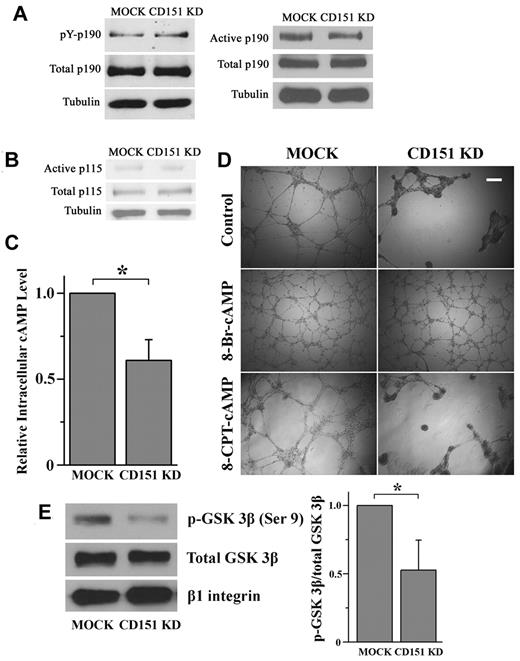 Figure 5. How CD151 maintains the balance of RhoA and Rac1. (A-B) CD151 does not affect p190RhoGAP and p115RhoGEF activation. (A) Cellular p190RhoGAP was immunoprecipitated with p190RhoGAP mAb. The amount of tyrosine-phosphorylated p190RhoGAP was determined by immunoblotting with the phosphotyrosine mAb PY99. After stripping, total precipitated p190RhoGAP was detected by p190RhoGAP mAb. The active form of p190RhoGAP (A) or p115RhoGEF (B) was detected by a GST pulldown assay using a GST-tagged, constitutively active RhoA mutant (Q63L) or GST-tagged, nucleotide-empty RhoA mutant (G17A), respectively. (C) CD151 silencing reduces the cAMP level in ECs. HMEC transductants were lysed in 0.1N HCl. cAMP contents in lysates were measured using a cAMP EIA kit. *P < .05. (D) 8-Br-cAMP, but not 8-CPT-cAMP, stabilizes the network structures of CD151-silenced ECs. HMEC transductant cells were incubated with 8-Br-cAMP (500μM) or 8-CPT-cAMP (500μM) for the endothelial network formation assay. The images were taken 18 hours after incubation. Bar represents 250 μm. (E) CD151 silencing reduced PKA-phosphorylated GSK-3β in ECs. The phosphorylated GSK-3β at Ser9 residue in HMEC lysates was detected by Western blot using an anti–phospho-GSK-3β (Ser9) Ab and quantified by densitometry (mean ± SE, n = 4). *P < .05. The treatment of PI3K inhibitor LY294002 did not alter the difference in GSK-3β (Ser9) phosphorylation between MOCK and CD151 KD groups.