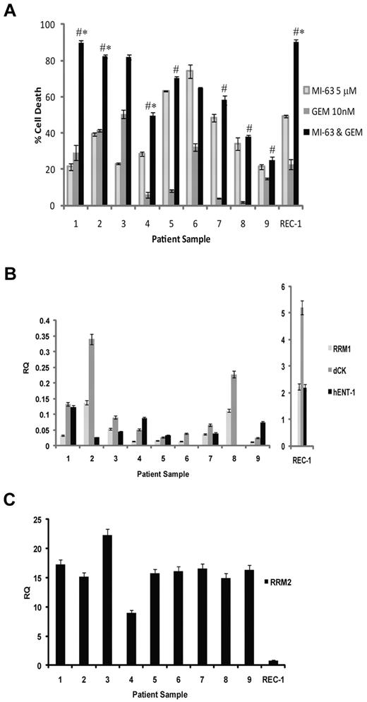 Figure 5. Synergistic activity of MI-63 and dFdC in MCL patient samples. (A) MCL cells were purified from the peripheral blood of patients with circulating neoplastic cells using magnetic-activated cell sorting and CD19 microbeads. These cells were then either exposed to 5μM MI-63, 10nM dFdC, or both agents simultaneously for 24 hours. Cell death was determined by flow cytometry using annexin-V and TO-PRO-3 staining relative to the vehicle-treated control, and REC-1 cells were included as an additional control. Each panel provides representative data from 1 of 3 independent experiments, and *P < .05 denote significance relative to MI-63 alone, and #P < .05 denote significance relative to dFdC alone. (B) Aliquots of each of the primary samples analyzed in panel A also were subjected to RNA extraction, cDNA was synthesized, and the levels of RRM1, dCk, hENT-1, and RRM2 were measured by quantitative real-time PCR using the ΔΔCT method with the JVM-2 cell line used as a relative calibrator. The transcript level in REC-1 cells also was measured as a control and is plotted on a separate scale because of their high expression of RRM1, dCK, and hENT-1. (C) Real-time PCR analysis of RRM2 transcript levels in MCL patient samples is shown, along with REC-1 as a cell line control.