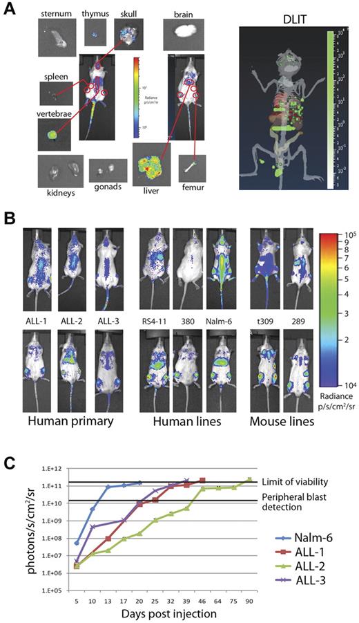 Figure 2. Bioluminescence can be used to distinguish patterns and timing of organ involvement for both human and mouse leukemia. (A) Prone, supine, and organ images of an NSG mouse injected with 1 × 106 ffluc+ primary ALL-1 cells. Outlined 2D regions of interest correspond to organ involvement validated at day 3 of engraftment by isolated imaging. DLIT image of mouse internal anatomy, with skin and gut removed for clarity, reconstructed from images is shown (right panel). Green voxels represent point sources of light within putative target organs, verified by ex vivo imaging and flow cytometry. (B) Day 3 intensity maps of NSG mice injected with 1 × 106 ffluc+ leukemia cells as indicated. These representative mice show the differing patterns of organ involvement at this early time point. Human ALL cells establish within the liver and bone marrow (primary ALL, RS4-11, and Nalm-6) or bone marrow only (380), whereas both mouse cell lines studied rapidly home to the spleen and bone marrow (t309 and 289). (C) Time course of leukemia engraftment reveals consistent bioluminescent correlation with appearance of peripheral blasts and maximal moribund disease burden. Nalm-6 (20-22 days), primary ALL-1 (40-50 days), primary ALL-2 (80-100 days), and primary ALL-3 (35-40 days) all become moribund at 2 × 1011 photons/s/cm2. Appearance of peripheral blasts (> 1%) happens consistently at systemic bioluminescent tumor burdens of > 1 × 1010 photons/s/cm2. In ALL-2, the stable bioluminescent burden from 46 to 75 days corresponds with stable but high peripheral blast burden (30%-50%) before a progression to end stage between 80 and 100 days. Results are presented as mean ± SE (n = 5 for primary ALL samples, n = 10 for Nalm-6).