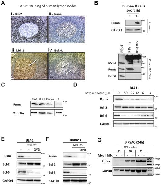 Figure 2. Expression of Puma in normal and malignant B cells was associated with a germinal center phenotype. (A) Expression of Bcl-2 (i), Puma (ii), Mcl-1 (iii), and Bcl-xL (iv) was assessed in histologic sections of human lymph nodes by in situ immunostaining (×100 magnification). As a control, the same tonsil sample was stained with normal rabbit serum (at a dilution 1/8000) using the same protocol that was used for detection of PUMA (data not shown). (B) Tonsilar B cells (2 × 106 cells/mL) were activated in culture with SAC (1/10 000) for 24 hours. Cells were lysed in CHAPS buffer and cell lysates (50 μg protein) were immuno-precipitated with antibodies against Puma or control Ig. Immune complexes as well as input from Puma immunoprecipitates were analyzed by immunoblotting with antibodies against Mcl-1, Bcl-xL, or Puma. The asterisk represents a nonspecific cross-reactive band. (C) Expression of Puma and tubulin (loading control) was analyzed by immunoblotting in 3 Burkitt lymphoma–derived cell lines (BJAB, BL41, and Ramos) and compared with the expression levels in purified human tonsillar B lymphocytes. (D) BL41 cells were cultured for 24 hours in presence of various doses of the c-Myc inhibitor 10058-F4. Expression levels of Puma, Bcl-2, Bcl-6, and GAPDH (loading control) were analyzed by immunoblotting. (E-F) BL41 cells (E) or Ramos cells (F) were treated in culture for 24 hours with the c-Myc inhibitor 10058-F4 (20μM) in the presence or absence of the broad spectrum caspase inhibitor QVD-OPH (10nM). Expression levels of Puma, Bcl-2, Bcl-6, and GAPDH (loading control) were examined by immunoblotting. (G) Tonsilar B cells (2 × 106 cells/mL) were activated with SAC (1/10 000) in the absence or presence of the c-Myc inhibitor 10058-F4 (20μM) for 24 hours: mRNA levels for Puma and GAPDH were analyzed for various cycles of PCR. Results are representative of 3 independent experiments.