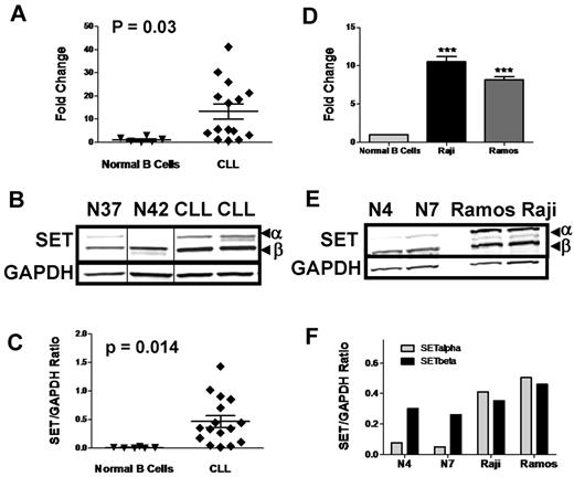 Figure 1. SET is overexpressed in CLL and NHL. (A) mRNA was isolated from 15 CLL patients and 6 normal B-cell samples, and SET mRNA was quantified by quantitative PCR. (B) Representative immunoblot of 2 normal B-cell extracts (N37 and N42) and 2 CLL cell extracts showing overexpression of both the α- and β-isoforms of SET as indicated in the CLL cells. Vertical lines have been inserted to indicate a repositioned gel lane. (C) SET/GAPDH protein ratios measured for 16 CLL patients and 6 normal B-cell samples used in panel A, showing a significant increase in expression of SET mRNA in B-CLL cells relative to normal B cells. (D) SET mRNA levels from 2 normal B-cell samples and Raji and Ramos cells quantified by quantitative PCR. ***P < .001 (E) Immunoblotting of 2 normal B-cell (N4 and N7) and Raji and Ramos cell extracts. Although SET levels appear higher in the normal samples, it is because of higher-intensity settings for this blot than the normals shown compared with the CLL samples in panel B. (F) Quantitation of the α- and β-isoforms of the SET protein (normalized to GAPDH) for Raji and Ramos NHL cell lines showing that the major increase in SET levels is because of increased α-isoform expression.