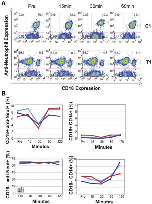 Figure 2. Analysis of percentage change in CD18+ and CD18− antineutrophil+ and CD14+ subsets in the circulation over time. (A) Flow cytometric analysis of the proportion of anti-neutrophil–expressing CD18+ and CD18− cells after G-CSF administration in a control dog (C1) and a transplanted dog (T1). (B) Graphic analysis of all 3 transplanted dogs (T1-T3) after G-CSF administration, demonstrating changes in the percentage of CD18+ and CD18− anti-neutrophil+ and CD14+ leukocyte subsets over time.