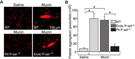 Figure 2. Mucins require P-selectin on platelets but not on endothelial cells to generate microthrombi in vivo. Transplantation of bone marrow into lethally irradiated mice was used to generate mice lacking P-selectin in platelets or in endothelial cells. (A) Representative images of lung sections prepared 5 minutes after intravenous injection of mucins or saline. (B) Quantification of CD41-positive pixels in lung sections. The data represent the mean ± SEM, n = 5-6 for each group. *P < .001.