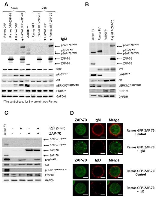 Figure 1. ZAP-70 enhances IgM-BCR signaling but does not participate in IgD-BCR signaling. (A) Ramos stable transfectants were stimulated with 5 μg/mL F(ab′)2 anti-IgM for 5 minutes and 24 hours. Enhanced Syk, Akt, and ERK1/2 phosphorylation was observed in IgM-BCR stimulated ZAP-70–expressing cells. (B) Immunoblotting analysis of Raji transfectants expressing constitutive phosphorylated ZAP-70 and ERK1/2. Ramos and Jurkat cells treated with pervanadate (PV) were used as positive controls. (C) Ramos stable transfectants were stimulated with 5 μg/mL F(ab′)2 anti-IgD for 5 minutes. On IgD stimulation, activation of Akt, but not of ERK1/2 or ZAP-70, was observed. Jurkat cells treated with PV were used as positive control. (D) Confocal microscopy (original magnification ×63). Ramos GFP-ZAP-70 cells were activated with 20 μg/mL F(ab′)2 anti-IgM or IgD for 40 minutes and then stained with anti–IgM-PE or anti–IgD-PE. ZAP-70 was translocated from the cytoplasm to the membrane and remained on surface after IgM activation while IgM internalization was almost complete (top panel). In contrast, while IgD was also internalized, no mobilization of ZAP-70 was observed after IgD stimulation (bottom panel). The scale bar in the image represents 5 μm.