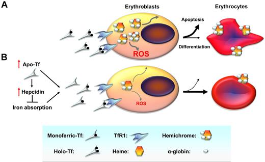 Figure 1. Cellular mechanisms by which decreased iron uptake into erythroid precursors may promote survival and differentiation. (A) In β-thalassemia, a relative excess of α-globin synthesis leads to formation of hemichromes (α-globin/heme aggregates). Hemichromes are the primary cause of cellular toxicity in β-thalassemia because they precipitate and lodge on erythrocyte membranes, altering their structure. Furthermore, excess heme leads to the formation of reactive oxygen species (ROSs), which induce oxidative stress and cellular damage. In turn, this leads to IE by increasing apoptosis of erythroid precursors and reducing the number of erythrocytes produced as well as their survival in circulation. (B) On the basis of our data, we observe that administration of apo-Tf and increased hepcidin expression lead to decreased serum iron concentration and formation of fewer holo-Tf molecules. This reduces iron delivery to erythroid precursors, reducing heme synthesis and formation of hemichromes. In contrast, decreased iron intake limits hemichrome and ROS formation, ameliorating IE by reducing apoptosis, and improving erythrocyte survival in circulation. TfR1 indicates transferrin receptor 1.