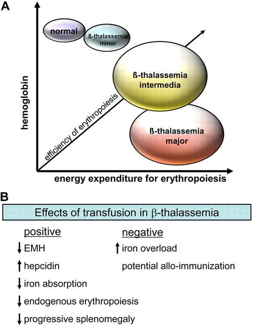Figure 2. Efficiency of erythropoiesis and effect of transfusion in β-thalassemia. (A) Severity of disease depends on both the degree of anemia and the systemic energy expenditure for erythropoiesis. For example, persons for whom the production of 6 g of hemoglobin (Hb) requires expansion of extramedullary erythropoiesis (EMH) in the liver and spleen, resulting in splenomegaly and changes in bone architecture, and the systemic cost of erythropoiesis is high. Although such a person would probably have his or her disease classified as TI, the initiation of chronic transfusion may improve the quality of life in such cases. (B) Transfusion has a significant number of benefits in β-thalassemia, although the consequent iron overload and potential for alloimmunization are debilitating complications.