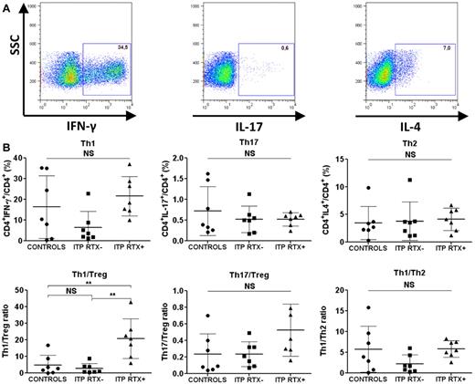 Figure 3. Splenic T-cell responses. Sorted CD4+ T cells were stimulated with PMA and ionomycin for 8 hours. Brefeldin A was added for the last 4 hours. The cells were then fixed and permeabilized for IFN-γ, IL-17, and IL-4 intracellular staining. (A) Th1 cells were defined as CD4+IFN-γ+, Th17 cells as CD4+IL-17+, and Th2 cells as CD4+IL-4+. Dot plots are of one representative RTX-treated ITP patient. (B) Data are summarized in dot plots representing the different T-cell subsets (Th1, Th17, and Th2) in controls (n = 7), RTX-untreated ITP patients (ITP RTX−; n = 7), and RTX-treated patients (ITP RTX+; n = 7). The balance between immune response and immune tolerance was evaluated by assessing the Th1/Treg and Th17/Treg ratios. The Th1/Th2 ratio is also represented. The horizontal bars represent the mean values with standard deviations. *P < .05; **P < .001; ***P < .0001; NS, nonsignificant.
