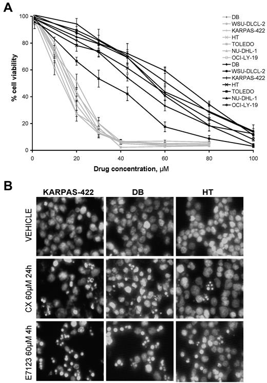 Figure 1. Cytotoxic activity and induction of apoptosis by celecoxib and E7123 in DLBCL lines. (A) Viability/concentration curves for celecoxib (black) or E7123 (gray) on DLBCL cell lines after 4-hour exposure. Error bars represent SE. (B) Apoptotic induction was evaluated by Hoechst staining after 24-hour exposure to 60μM celecoxib (CX) and 4-hour exposure to 60μM E7123 (original magnification ×400). Slides were viewed with an inverted microscope (Axiovert 200M). Images were acquired using a digital camera (Coolsnap; Photometrics) and processed with MetaMorph Version 5.01 software.