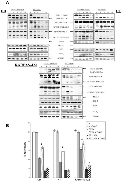 Figure 3. Signal transduction associated with apoptotic induction and effect of caspase inhibition in the antitumor effect of celecoxib or E7123 on DLBCL cell lines. (A) Immunoblot analyses of DB, HT, and KARPAS-422 cells treated with vehicle (V), 60μM celecoxib, or E7123 for different time periods (4, 8, 15, and 24 hours). Equal loading was checked by immunobotting with GAPDH. Expression levels of Mcl-1 in DB cells and Bcl- 2 in HT cells are not shown because they were undetectable. (B) Antitumor effect of 60μM celecoxib (CX) or 30μM E7123 after 4-hour exposure in DB, HT, and KARPAS-422 cells pretreated for 1 hour with the pancaspase inhibitor ZVAD at 50μM. Error bars represent SE. Statistical analysis was performed using the Mann-Whitney test: *P < .05.
