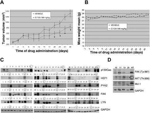 Figure 6. Antitumor activity of E7123 in an in vivo xenograft model and FA protein signaling in DLBCL patient samples. (A) Swiss-nude mice were injected in the flank with 10 × 106 HT cells and treated with vehicle or 100 mg/kg of E7123 as described in “Animal experiments.” Tumor volumes were plotted against days of treatment. A significant reduction of tumor volume can be observed after 22 doses. Error bars represent SD. Statistical analysis was performed using the Mann-Whitney test. *P < .05. (B) Weights of each mouse were monitored daily, and the mean weight of each group was plotted against days of treatment to assess E7123 toxicity. (C) Immunoblot analyses of p130Cas, HEF1, FAK, PYK2, and LYN in whole protein extracts of 29 DLBCL patient samples. Positive control samples for each particular protein are marked with a circled “C.” GAPDH was used as a control for protein loading. (D) Immunoblot of phosphorylated FAK, AKT, and Mcl-1 on 4 DLBCL patient samples. GAPDH was used as a control for protein loading.