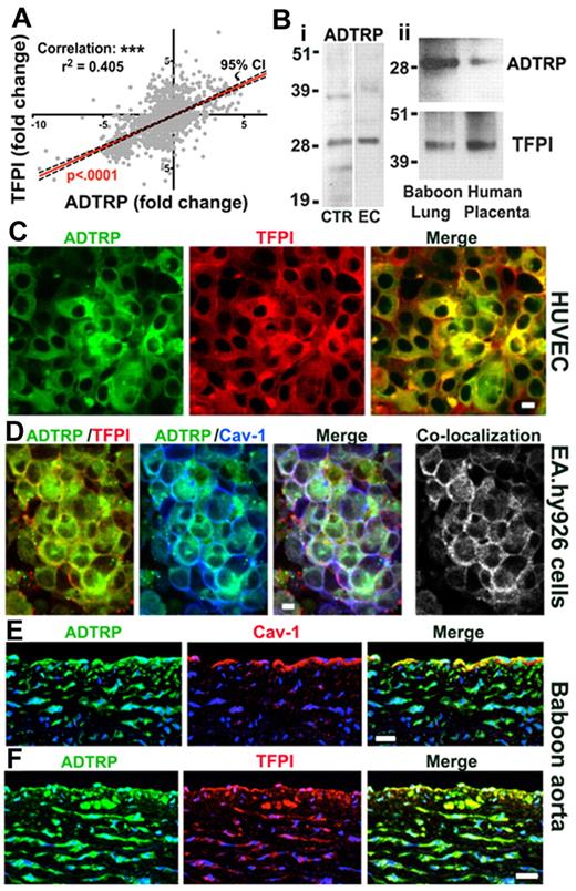 Figure 1. Analysis of the expression and cellular distribution of ADTRP, a novel protein that coregulates with TFPI. (A) Coexpression plot (red) of ADTRP and TFPI resulted from the GAMMA of GEO microarrays shows significant positive correlation between the expression levels (represented as fold-change) of the 2 genes. P < .0001 for the slope's deviation from zero. n = 1500. Confidence interval (CI; 95%) is shown as black interrupted lines. (B) Western blot performed on (i) cellular lysates of HEK293T (positive control, lane CTR) and EAhy926 (lane EC), and (ii) tissue extracts of normal baboon lung and human placenta, using rabbit anti-ADTRP and anti-TFPI IgGs for probing. (C-F) Immunofluorescence and confocal microscopy show the localization of ADTRP in human ECs in culture and the baboon aorta. Non-permeabilized HUVECs (C) were immunostained for cell surface ADTRP (FITC, green) and TFPI (Cy3, red). EA.hy926 cells (D) were first immunostained for cell surface ADTRP (FITC, green) and TFPI (Cy3, red), then permeabilized and immunolabeled for Cav-1 (Cy5, blue). Overlap (white) designates the colocalization channels obtained by Adobe Photoshop image analysis. Baboon aorta sections were immunostained for ADTRP (FITC, green) and Cav-1 (E) or TFPI (F; Cy3, red for both) after brief permeabilization.10,11 Blue: nuclear staining. Bars: (C-D) 10 μm; (E-F) 50 μm.