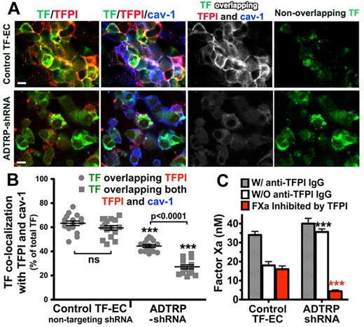 Figure 3. Silencing of ADTRP decreases cell surface TFPI expression and activity. (A) Immunofluorescence and confocal microscopy showing the distribution and colocalization of cell surface TFPI (Cy3, red) with YFP-TF (YFP, green) and Cav-1 (Cy5, blue; after permeabilization) on controls (nontargeting shRNA) and ADTRP shRNA-expressing TF-EC. Triple overlapping (white) and nonoverlapping TF (green) channels were generated by the Adobe Photoshop image analysis. Bars: 10 μm. (B) Scatter-plot and statistical analysis (1-way ANOVA) of the colocalization percentage between TF and TFPI, and TF/TFPI/Cav-1, out of the total MFI of TF. ***P < .001 for both sets of data in the ADTRP-shRNA group compared with control (nontargeting shRNA) TF-EC group. ns, P > .05 for the difference between the sets of data within the control experimental group. Data are mean ± SEM. (C) The inhibitory capability of cell surface TFPI against TF-FVIIa–dependent FXa generation measured in TF-EC in the presence/absence of inhibitory anti-TFPI IgG. Values are normalized to 106 cells. ***P < .001 versus control (unpaired t test). Data are mean ± SD of triplicates.