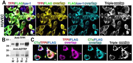Figure 6. Localization of ADTRP and TFPI in caveolae/lipid rafts. (A) Immunofluorescence shows the distribution and colocalization of cell surface TFPI (Cy3, red) and FLAG (FITC, green) with Cav-1 (Cy5, blue; after permeabilization) on HUVEC stable expressing ADTRP-FLAG. Double and triple colocalization channels resulted from image analysis. (B) Representative Western blot with rabbit anti-ADTRP and anti-TFPI IgGs shows the partition of TFPI and ADTRP in the water (W, lanes 1 and 3) and detergent (D, lanes 2 and 4) cellular fractions after extraction with Triton X-114 and phase separation of control ECs (lanes 1 and 2) and stable ADTRP-expressing cells (lanes 3 and 4). (C) Immunofluorescence showing clustering and enhanced colocalization (triple overlap, white) of cell surface TFPI (Cy3, red) and FLAG (Cy5, blue) together with Cholera Toxin B (CTx)–FITC (green) after live incubation at 37°C of ADTRP-FLAG-expressing EC with CTx-FITC (ligand for the lipid raft marker GM1). Bars: 10 μm.