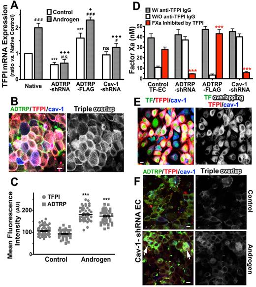 Figure 7. Androgen regulates the expression and distribution of TFPI and ADTRP, and TFPI activity. (A) mRNA expression of TFPI assayed by qRT-PCR in control ECs (open bars) and cells incubated with 30nM DHT for 24 hours (gray bars). The effect of DHT was studied in Native cells, and in ADTRP-shRNA–, ADTRP-FLAG–, and Cav-1-shRNA–expressing EAhy926 cells. Values are presented as fold-change from native control ECs after correction for 18S rRNA as internal control. Experiments were repeated twice and run in triplicate. (B) Immunostaining for ADTRP (FITC, green) and TFPI (Cy3, red) on the cell surface, and Cav-1 (Cy5, blue) after permeabilization on HUVECs treated with DHT. Overlap (white) designates the colocalization channel resulting from the image analysis. (C) Scatter-plot and statistics (1-way ANOVA) of MFI of cell surface TFPI and ADTRP measured on cells processed as in panel (B). Control cells were treated similarly to the Androgen-group but without DHT. Data are mean ± SEM. ***P < .001 for both sets of data in the Androgen-group compared with the Control-group. (D) Effect of DHT on the inhibitory capability of cell surface TFPI against TF-FVIIa–dependent FXa generation measured in TF-EC in the presence/absence of inhibitory anti-TFPI IgG. Values are normalized to 106 cells. Data are mean ± SD of triplicates. The groups of cells and DHT treatment were as described in panel A. (E) Immunofluorescence and confocal microscopy show the effect of DHT on the distribution and colocalization of cell surface TFPI (red) with YFP-TF (green) and Cav-1 (blue; after permeabilization) on TF-EC. Triple overlap (white) channel resulted from the image analysis. (F) Immunofluorescence for cell surface TFPI (Cy3, red) and ADTRP (FITC, green), and Cav-1 (Cy5, blue; after permeabilization) in EC stable expressing Cav-1–shRNA, either native (Control) or incubated with DHT (Androgen). Overlap (white) designates the triple colocalization channel. White arrows: residual Cav-1 expression. (A, D) Statistical analysis was performed by 1-way ANOVA. *,#,♦: P < .05, **,##,♦♦: P < .01, ***,###,♦♦♦: P < .001, N.S. and ns, P ≥ .05. Asterisks (*) and ns: difference versus Native within the Control-group. Diamonds (♦): difference versus Native within the Androgen-group. Pound signs (#) and N.S: difference between Androgen-treated versus Control cells within each experimental group. Bars: 10 μm.