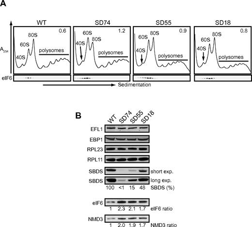 Figure 5. Lymphoblasts from SDS patients exhibit defective ribosome assembly. (A) Comparison of polysome profiles from wild type and SDS patient–derived lymphoblastoid cell lines. Proteins were immunoblotted to visualize eIF6. Ribosomal subunit ratios (605:805) are indicated in the top right corner. SBDS genotypes in the patient-derived lymphoblastoid cell lines (SD74, SD55, and SD18) are provided in supplemental Table 4. (B) Extracts from wild type and 3 SDS patient–derived lymphoblastoid cell lines were immunoblotted to visualize the indicated proteins.