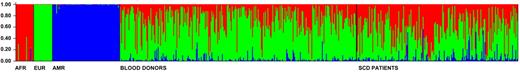 Figure 1. Individual admixture in healthy blood donors and Sickle Cell Disease patients from Minas Gerais. Admixture was estimated using the method by Pritchard et al implemented in the software Structure.11 Each vertical bar represents an individual and his/her admixture proportions based on the parental populations on the left. Additional methodologic information and results are available as supplemental Methods. Structure was run using the following conditions and parameters: K = 3 (number of parental populations), burn-in period = 100 000, MCMC cycles after burn-in = 100 000, we used a priori information for the individuals from parental populations to assist the clustering (USEPOPINFO = 1), model = ADMIXTURE for the admixed individuals, α parameter was inferred for each population, GENSBACK = 2, MIGRPRIOR = 0.05, allele frequencies was assumed to be correlated.