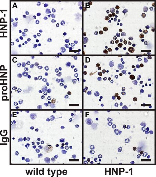 Figure 2. Immunocytochemical staining of murine BM cells from wild type and HNP-1 mice. BM cells were extracted from wild-type and HNP-1 mice. Cells were spun onto slides, fixed, permeabilized, and immunocytochemically stained for (A-B) HNP-1, (C-D) proHNP, and (E-F) IgG control. Bars represent 20 μm.