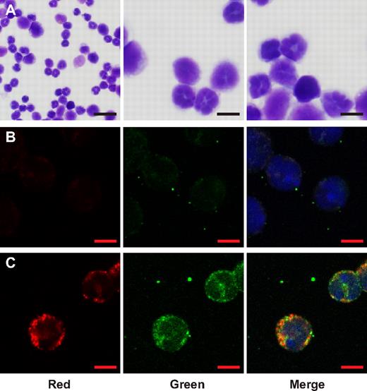Figure 4. Localization of serglycin in relation to HNP-1 in granulocytic BM cells of transgenic HNP-1 mice. Murine BM from transgenic HNP-1 mice was extracted and nongranulocytic cells diminished by ammonium chloride-based lysis and immunomagnetic sorting. Cells were fixed with paraformaldehyde and spun onto slides. (A) May-Grünwald staining of sorted cells: Overview (left) and 2 close-ups. Bars represent 20 μm (left) or 5 μm. (B-C) Immunofluoresence microscopy: Primary Abs were detected with Alexa Fluor 594 or 488 Abs and DNA was stained with DAPI. Red bars represent 5 μm. (B) Cells IgG control (red and green). (C) Cells stained for serglycin (red) and HNP-1 (green). Images were acquired with a Zeiss LSM 700 microscope and merged with Zen 2009 LE software.