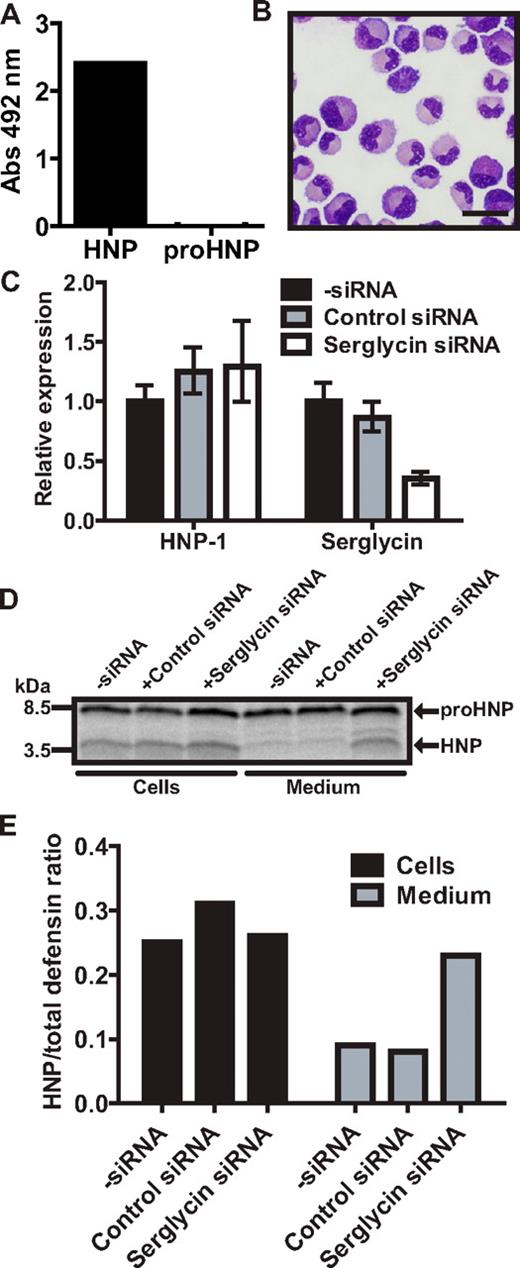 Figure 6. Biosynthesis of proHNP and HNP in human BM. (A) Myeloblasts/promyelocytes were isolated from human BM by density centrifugation and subjected to a mixed ELISA: immunoplates were incubated with anti-serglycin Ab. Plates were washed, blocked, and incubated with cell lysate. Association of a protein with serglycin was probed with biotinylated Abs against proHNP, which does not recognize fully processed HNP-1, and against HNP-1, which does recognize fully processed HNP-1. After incubation with HRP-conjugated avidin, a color reaction was developed using OPD tablets. Color reaction was measured at an absorbance (Abs) of 492 nm and background reactivity subtracted (absorbance in wells with lysis buffer without cells). Absorbance points to an association of a protein with serglycin. (B) Human BM cells were sedimented with dextran. Supernatant was laid on Lymphoprep and centrifuged at 400g for 30 minutes. Interphase cells were depleted of nongranulocytic cells by immunomagnetic sorting, spun onto slides, and May-Grünwald-Giemsa stained. Bar represents 20 μm. (C) Purified granulocytic precursors were electroporated with siRNA against serglycin, control siRNA, or without siRNA and incubated for 20 hours in a humidified incubator with 5% CO2 at 37°C. Comparative quantification of mRNA for HNP-1 and serglycin. Figure depicts expression levels relative to cells electroporated without siRNA. (D) Transfected granulocyte precursors were pulsed with 35S-methionine/cysteine for 1.5 hours and chased for 3 hours. Cell lysates and medium were immunoprecipitated with Abs against proHNP followed by HNP. Immunoprecipitates were pooled and analyzed by 16% SDS-Tricine-PAGE and fluorography. (E) Ratio of fully processed HNP compared with proHNP in cells and chase medium.