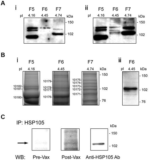 Figure 2. Serological identification of HSP105 in B-NHL. (A) WB analysis of OFFGEL fractions from DOHH-2 proteins (F5, F6, and F7) probed with prevaccination (i) and postvaccination (ii) Igs from responder 14. (B) Silver staining of F5, F6, and F7 preparative SDS-PAGE for MS of the numbered protein bands (i) and WB analysis of F6 probed with polyclonal anti-HSP105 Ab (ii). (C) Immunoprecipitation (IP) of HSP105 from DOHH-2 whole cell lysate with polyclonal anti-HSP105 Ab, followed by WB analysis using pre- and postvaccination (Vax) Igs from responder 14, or mouse anti-HSP105 mAb as control. pI indicates isoelectric point.