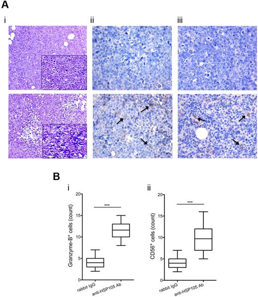 Figure 6. Antitumor effects of HSP105 targeting in the NAMALWA model. (A) IHC of NAMALWA xenografts from control rabbit IgG- (top) and anti-HSP105 Ab-treated (bottom) animals. Representative hematoxylin and eosin (i), Granzyme B (ii), and CD56 (iii) stainings. Digital images were acquired with Leica DFC320 digital camera and Leica DM2000 microscope, and processed using Photoshop CS4 software version for Macintosh Pro personal computer. Original magnifications: i, ×200; ii,iii, ×400; and insets, ×400. (B) Absolute number of Granzyme B+ (i) and CD56+ (ii) cells in sections from control rabbit IgG- and anti-HSP105 Ab-treated xenografts. Immunoreactive cells (ie, yellow/brown-stained cells) were counted in 5 high-power microscopic fields (original magnification, ×400) for each condition, and the result was expressed as an average. The boxes extend from the 25th to the 75th percentiles, the lines indicate the median values, and the whiskers indicate the range of values. Results from 2 independent experiments are shown. Statistically significant differences between groups were assessed with the unpaired 2-tailed Student t test: ***P < .001.