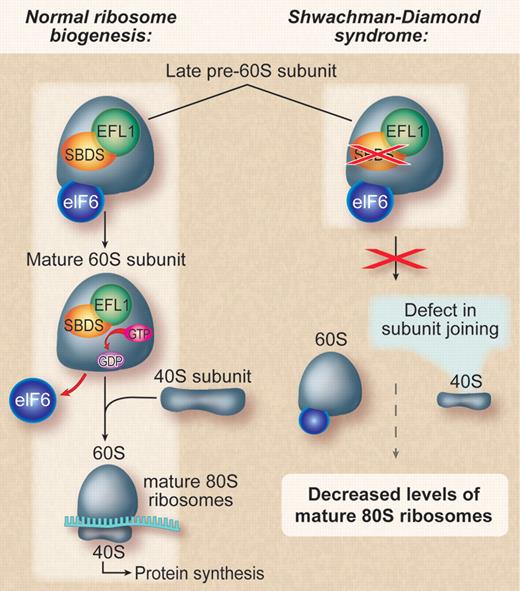 Proposed mechanism for the cellular consequences of mutations in Shwachman-Bodian-Diamond syndrome. Left panel: Normal cell with unperturbed ribosome biogenesis and proper joining of the ribosomal subunits. Right panel: Mutations in SBDS lead to a failure to evict eIF6 resulting in a defect in subunit joining and a subsequent decrease in levels of translationally active mature 80S ribosomes. Professional illustration by Debra T. Dartez.