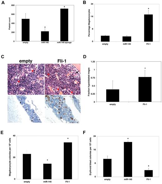 Figure 3. miR-145 and Fli-1 regulate megakaryocyte and erythroid differentiation in vivo. (A) Relative to an empty vector, miR-145 overexpression reduces peripheral blood platelet counts, whereas an miR-145 sponge increases platelet counts 5 to 6 weeks after bone marrow transplantation into BALB/C recipient mice. Platelet counts were assessed from peripheral blood of mice transplanted with hematopoietic progenitors infected with an empty vector (empty), a vector overexpressing miR-145 (miR-145), or a vector expressing a sponge targeting miR-145 (miR-145 sponge). (B) Relative to an empty vector (empty), overexpression of Fli-1 promotes total megakaryocyte differentiation 5 to 6 weeks after bone marrow transplantation into C57BL/6 animals. The percentage of GFP-positive mononucleated cells from the megakaryocyte lineage was assessed by flow cytometry with antibodies against CD41 and CD61. Values are mean ± SEM (n = 3). (C) H&E and von Willebrand factor staining of bone marrow from the sternum of C57BL/6 mice transplanted with HSCs infected with control virus (empty), virus overexpressing miR-145 (miR-145), and virus overexpressing Fli-1 (Fli-1). Arrowheads indicate normal megakaryocytes; and arrows, smaller megakaryocytes with hypolobated nuclei. Note the increased numbers of megakaryocytes in Fli-1-overexpressing HSCs seen both by hematoxylin and eosin and von Willebrand factor staining. Original magnifications: H&E ×1000; and von Willebrand factor ×200. The samples were analyzed using an Olympus BX41 microscrope with the objective lens of 100×/0.75 Olympus UPlanFL or 20×/0.75 Olympus UPlanFL (Olympus). The pictures were taken using Olympus QColor5 and analyzed with acquisition software QCapture Pro Version 6.0 (QImaging) and Adobe Photoshop CS3 (Adobe). (D) Quantitation of hypolobated micromegakarycoytes was performed by pathologic analysis of an independent set of transplantations into BALB/C animals. (E) Bone marrow cells from empty, miR-145, or Fli-1–overexpressing C57BL/6 recipient animals were plated in megakaryocyte differentiation media. Megakaryocyte colonies were quantitated from 1.1 × 106 sorted cells. These experiments were performed in triplicate and replicated twice. (F) Bone marrow cells from empty, miR-145, or Fli-1–overexpressing C57BL/6 recipient animals were plated in methylcellulose, and 1 × 105 transduced bone marrow cells were assayed for erythroid blast colonies. Values are mean ± SEM (n = 3) with propagated error. These experiments were performed in triplicate and replicated twice. *P < .05.