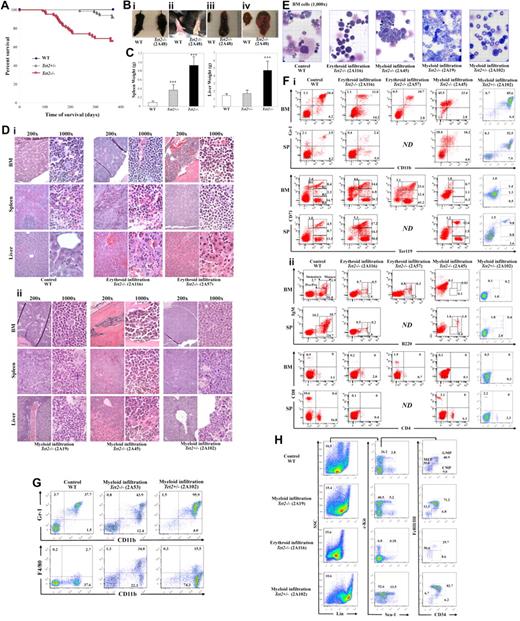 Figure 3. Tet2−/− mice evolved to lethal myeloid malignancies. (A) Kaplan-Meier survival curve of WT (n = 48), Tet2+/− (n = 66), and Tet2−/− (n = 62) mice up to 1 year of age. (B) Appearance of a representative moribund Tet2−/− mouse (2A48) with distended abdomens (i) and pale footpads (ii), the gross morphology of spleen (iii), and liver (iv) of this moribund Tet2−/− mice are drastically different from WT control. (C) Spleen and liver weights of moribund/deceased Tet2−/− (n = 18) and Tet2+/− (n = 5) mice as well as age matched WT controls. (D) H&E staining of paraffin-embedded sections of spleen, liver, and femurs from representative deceased/moribund Tet2−/− (2A116, 2A57, 2A45, 2A19) and Tet2+/− (2A102) mice. (E) May-Giemsa–stained BM cytospin-preparations from representative deceased/moribund Tet2−/− (2A116, 2A45, 2A19) or Tet2+/− (2A102) mice. (F) Lineage distribution of BM and spleen cells of representative deceased/moribund Tet2−/− (2A116, 2A57, 2A45) and Tet2+/− (2A102) mice. (G) Flow cytometric analysis of monocytic lineages in representative deceased/moribund Tet2−/− (3G53) and Tet2+/− (2A102) mice. (H) Flow cytometric analysis of LSK (Lin–Sca-1+Kit+) and LK (Lin–Sca-1−Kit+) cell population in representative deceased/moribund Tet2−/− (2A19 and 2A116) and Tet2−/− (2A102) mice. The numbers indicate the percentages of cells in each cell population. ***P < .001.