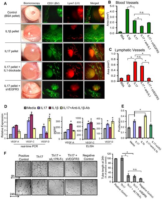 Figure 1. IL-17 promotes lymphangiogenesis by inducing VEGF-D secretion, and proliferation of and tube formation by LECs. (A) Pellets containing 100 ng of IL-1β, IL-17, or IL-17 along with systemic blockade of IL-1β or VEGFR3, were placed in corneal micropockets (n = 6 mice/group) to induce angiogenesis.17 After 7 days, corneas were evaluated biomicroscopically and then harvested for immunostaining with CD31 (green) and Lyve1 (red). Digital micrographs using epifluorescence microscopy were captured, and ImageJ 1.34s software was used to quantify the growth of (B) blood (CD31hiLyve1−) and (C) lymphatic (CD31loLyve1+) vessels. (D) Primary human corneal epithelial cells were cultured with 10 ng/mL concentration of IL-1β, IL-17, and IL-17 with IL-1β–blocking antibodies for 24 hours, and expression levels of VEGF-A, VEGF-C, and VEGF-D mRNA in cells, and protein in culture supernatants, were measured by real-time PCR and ELISA, respectively. (E) Primary human LECs were cultured with 10 ng/mL concentrations of IL-1β, IL-17, and IL-17 with blockade of IL-1β or VEGFR-3 for 24 hours, and then proliferation was measured using BrdU incorporation assay. (F) In a transwell Matrigel assay, in vitro polarized 2 × 105 Th17 cells (in transwell) were cocultured with 5 × 104 LECs (on Matrigel) in basal MEM with reduced serum (2% FBS). Positive controls consisted of LEC cultures on Matrigel in MEM supplemented with growth factors (5% FBS, VEGF, FGF, EGF). Negative controls consisted of LEC cultures on Matrigel in basal MEM only with reduced serum (2% FBS). In some wells of Th17-LEC coculture, soluble-IL-17receptor-Fc or soluble-VEGFR3-Fc was added in media. After 8- and 24-hour incubation at 37°C, wells were visualized under bright-field inverted microscope to study the LEC tube formations on Matrigel, and digital micrographs were then captured for quantitative analysis of tube length. Data are mean ± SEM values of 3 independent experiments. *P < .05, as determined by Student t test. n.s. indicates not significant.