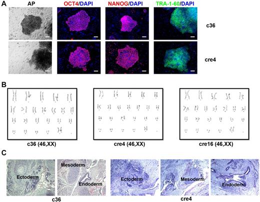 Figure 4. Characterization of gene-corrected SCD iPSC clones. Gene corrected SCD iPSC clones (c36 and cre4 shown here) display characteristic pluripotency markers such as alkaline phosphatase (AP), OCT4, NANOG, and TRA-1-60 (A); maintain normal karyotypes (B); and form teratomas bearing cells from all 3 germ layers, that is, ectoderm, mesoderm, and endoderm (C).