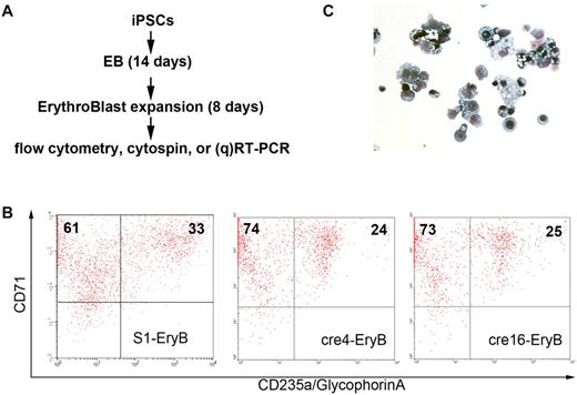 Figure 5. Erythroid differentiation of SCD iPSC clones. (A) In vitro hematopoietic differentiation of various iPSC clones to generate HBB-expressing erythroid cells. After 14 days of EB-mediated spontaneous differentiation, iPSC-derived cells were further differentiated and expanded into immature erythroid cells (erythroblasts or EryB) for another 8 days. Then, the erythroid cells were collected for flow cytometry, Giemsa stain of cytospin, and RT-PCR or qRT-PCR. (B) Flow cytometric analysis of S1, cre4, and cre16 using erythroid-specific surface markers CD71 and CD235a (glycophorin A). (C) Giemsa stain of confirming that most of differentiated cells are erythroblasts.