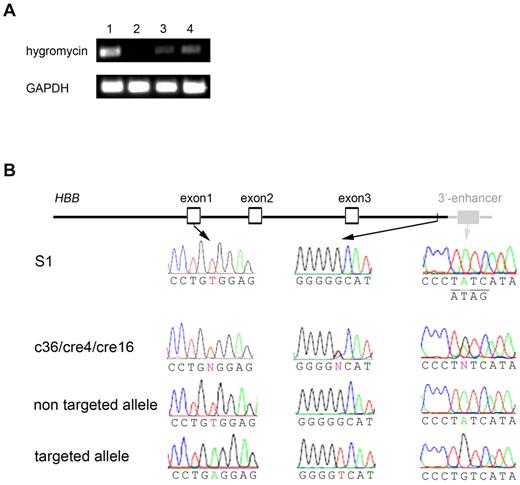 Figure 7. Investigation of reduced expression of the gene-targeted allele. (A) RT-PCR showed the same PGK-Hyg transgene was expressed at very low level in gene-targeted c36-iPSCs (lane 3) and c36-EryB (lane 4) compared with another iPSC line (FPHR, where the PGK-Hyg cassette was targeted into the actively expressed PIG-A gene,3 lane 1). Nontargeted S1-EryB cells were used as negative control (lane 2). (B) Sequencing of 3.5-kb genomic region of HBB locus in SCD iPSC clones. The 3.5-kb genomic region includes an ∼ 1.1-kb promoter, all the HBB exons and introns, and an ∼ 0.5-kb downstream sequence that were part of BD2 targeting donor (black lines/shapes/names) and also contains an ∼ 200-bp 3′-enhancer sequence (gray lines/shapes/names) downstream of the right homology arm. DNA sequencing of both alleles in early (p24) or late (p56) passage of S1 revealed uniform βS mutation in exon 1 and wild-type GATA site in 3′-enhancer (underlined with complementary strand sequence underneath). However, in c36, cre4, or cre16, sequencing of mixed alleles showed heterozygous nucleotides (N), including βA in exon 1, a G-to-T polymorphism near the 3′-end of the right homology arm, and an A-to-G mutation in GATA site all linked on gene-targeted allele.