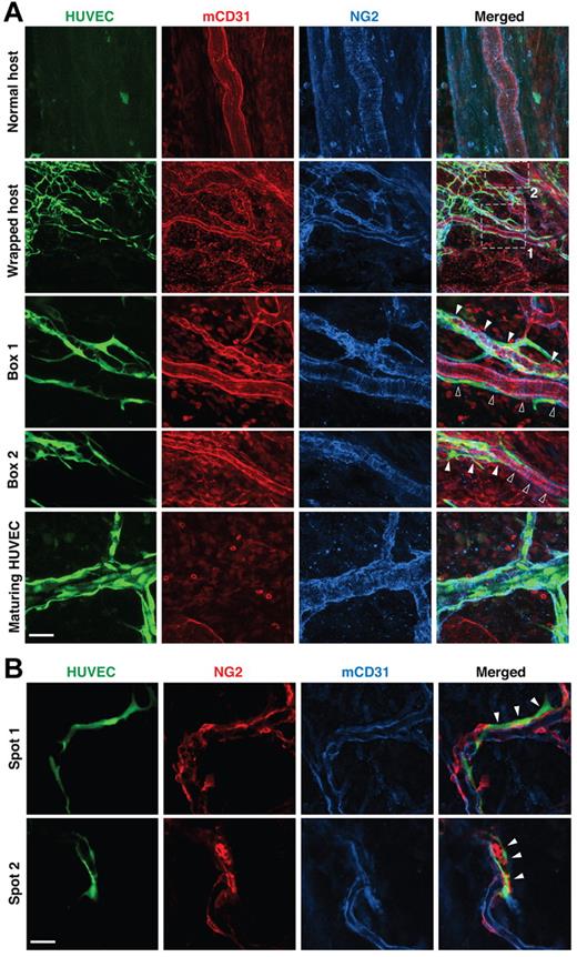 Figure 2. Wrapping HUVECs reorganize pericytes on host vessels. (A) Pericytes (blue, NG2 staining) appear normal around unwrapped, intact host vessels (row 1). Wrapping by HUVECs dramatically changes pericyte morphology (rows 2-4), but pericytes around maturing HUVEC vessels appear more normal (row 5). “Box 1” and “Box 2” show details of the areas within the white boxes in the “Wrapped host” panel. Empty and filled arrowheads highlight unwrapped and wrapped regions, respectively. Note that the disruption of host pericytes requires complete and tight wrapping by the HUVECs, not casual alignment as shown on the host vessel with empty arrowheads in “Box 1.” Whole-mount IHC stain; 60×/1.1 NA oil objective (rows 1, 3, 4 and 5) and 20×/0.95 NA water objective (row 2); scale bar represents 120 μm for row 2 and 40 μm for all the other rows. (B) When wrapping around host vessels (blue, mCD31 staining), HUVECs (green, GFP transduction) often lay on top of pericytes (red, NG2 staining) with little colocalization between the 2 (ie, very few pixels are yellow in the “Merged” panel). Filled arrowheads indicate where wrapping is taking place. Note that pericyte morphology on the wrapped host vessel is more abnormal in “Spot 2.” Whole-mount IHC stain; 20×/0.95 NA water objectie at 4.0× digital zoom; scale bar represents 30 μm.