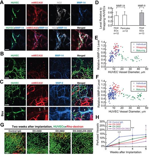 Figure 4. Wrapping HUVECs express high levels of MMP-14 and MMP-9, and inhibition of MMPs interferes with WAT anastomosis. (A) Strong MMP-14 expression (blue) colocalizes precisely with HUVECs (green, GFP transduction), but not with unwrapped parts of host vessels (red, mouse-specific MECA32, which is denoted mMECA32, staining) or pericytes (gray, NG2 staining). Filled arrowheads indicate unwrapped host ECs with weak MMP-14 staining; empty arrowheads indicate strong pericyte staining with weak MMP-14 signal. Whole-mount IHC stain; 20×/0.95 NA water objective at 3.0× digital zoom; scale bar represents 40 μm. (B) MMP-14 expression (blue) by wrapping HUVECs (filled arrowheads) is stronger than that by nonwrapping HUVECs (empty arrowheads) or maturing HUVEC vessels (arrows). Whole-mount IHC stain; 20×/0.95 NA water objective; scale bar represents 120 μm. (C) MMP-9 (blue) expression is strongest on wrapping HUVECs (filled arrowheads) compared with nonwrapping HUVECs (empty arrowheads) and maturing HUVEC vessels (arrows). “Box” shows the detail of the area within the white box. The dashed line divides the main HUVEC vessel in this panel into 2 parts: the one on the right is wrapping around some host vessel segments (empty arrows) and has very strong MMP9 staining, whereas the one on the left has no host vessel segments inside, is apparently maturing, and has much weaker MMP-9 staining. Whole-mount stain; 20×/0.95NA water objective; scale bar represents 120 μm. (D) MMP-14 expression (white bars) on unwrapped host ECs and pericytes is 46% ± 18% (n = 12) and 49% ± 16% (n = 12), respectively, that of wrapping HUVECs. MMP-9 expression (gray bar) by unwrapped host ECs is 59% ± 9% (n = 13) that of wrapping HUVECs. (E) MMP-14 expression by HUVECs changes with segment diameter and wrapping status. The normalized value is 0.67 ± 0.23 (n = 94) for “Individual,” nonwrapping HUVECs, 1.00 ± 0.18 (n = 25) for “Wrapping” HUVECs, and 0.54 ± 0.16 (n = 38) for “Maturing” HUVEC vessels. (F) MMP-9 expression by HUVECs also changes with segment diameter and wrapping status. The normalized value is 0.67 ± 0.20 (n = 153) for “Individual,” nonwrapping HUVECs, 1.000 ± 0.176 (n = 37) for “Wrapping” HUVECs, and 0.569 ± 0.126 (n = 47) for “Maturing” HUVEC vessels. (G) Typical perfusion (visualized by intravenous injection of Rho-dextran, which is shown in red) of implanted HUVEC networks (green, GFP transduction) 2 weeks after implantation when the animal is treated with control IgG, monoclonal antibody against MMP-14 (DX-2400), monoclonal antibody against MMP-9 (DX-2802), or DX-2400 + DX-2802. Intravital confocal images; 10×/0.3 NA air objective; scale bar represents 200 μm. (H) Treatment with DX-2400 and/or DX-2802 delays the onset of WAT anastomosis. Data were generated from the analysis of images, such as those shown in panel G. ***P < .05 between “Control IgG” and each of the other 3 groups. *P < .05 only between “Control IgG” and “DX-2400 + DX-2802.”