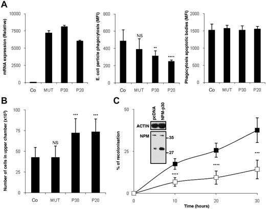 Figure 3. NPM-p30 and NPM-p20 participate in macrophage quiescence. Macrophages were obtained by M-CSF treatment of human peripheral blood monocytes for 4 days, transfected with an empty pcDNA3.1 vector, this vector expressing D213A-mutated NPM1 (MUT), the p30 N-terminal fragment of NPM1 (P30), or the p20 N-terminal fragment of NPM1 (P20). In all panels, NS indicates nonsignificant; **P < .025; ***P < .01; ****P < .001. (A) Left panel, reverse transcription–quantitative PCR of NPM1; control of overexpression. Middle panel, Phagocytosis of fluorescent E coli bioparticles was determined by flow cytometry (mean ± SD of mean fluorescence indexes, triplicates). Right panel, Phagocytosis of apoptotic bodies was determined by flow cytometry (mean ± SD of mean fluorescence indexes, triplicates) 24 hours after transfection. (B) Transwell migration assay; cells were counted in the top panel after 24 hours of migration. (C) Recolonization capabilities were monitored 24 hours later in a wound-healing assay. (Inset) NPM1 protein level was checked by immunoblotting 24 hours after transfection.