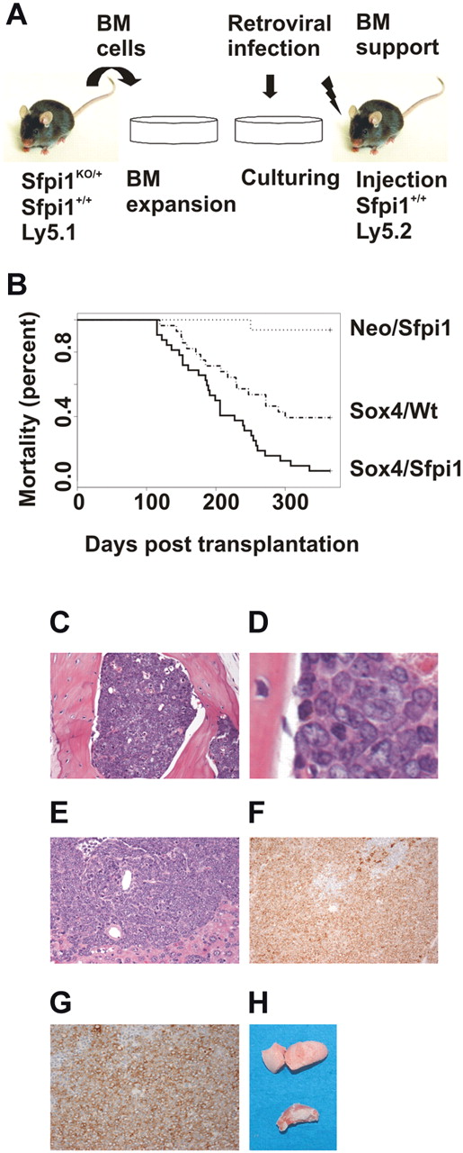 Figure 1. Sfpi1 haploinsufficiency cooperates with Sox4 to induce myeloid leukemia development. (A) A schematic diagram showing the bone marrow transduction and transplantation assay using Sfpi1KO/+ or Sfpi1+/+ bone marrow cells. (B) All-cause mortality curve is shown. The cohort of mice that received MSCV-Sox4 infected bone marrow cells from Sfpi1KO/+ mice is labeled as Sox4/Sfpi1 (32 animals). Mice that received MSCV-Sox4 infected bone marrow cells from wild-type C57/Bl/6J mice are labeled as Sox4/Wt group (28 animals). The Neo/Sfpi1 group contains mice that received marrow cells from Sfpi1KO/+ mice infected with MSCV (16 animals). Myeloid leukemias developed between 3 and 11 months. Statistical significance between groups using the log-rank test is: Neo/Sfpi1 versus Sox4/Wt (P < .001), Sox4/Wt versus Sox4/Sfpi1 (P < .001), Neo/Sfpi1 versus Sox4/Sfpi1 (P < .001). (C) H&E staining of bone marrow from a mouse of the Sox4/Sfpi1 cohort showing myeloid leukemia (original magnification ×40). (D) H&E staining of bone marrow from the same leukemic mouse showing myeloid blasts (original magnification ×400). (E) H&E staining of a spleen section from same mouse showing myeloid leukemia (original magnification ×40). (F) Representative liver section of the same mouse in panels C and D stained positive for myeloperoxidase (original magnification ×40). (G) Myeloperoxidase staining of bone marrow from a secondary transplantation is showing myeloid leukemia (original magnification ×40). (H) Top part of the picture shows a splenic tumor (myeloid leukemia, weight 0.16 g) day 26 of secondary transplantation compared with WT control spleen (bottom part of picture, weight 0.048 g). Images were captured on an Olympus Bx41 microscope, objective UPlan FI 40×/0.75 ∞/0.17, with an adaptor U-TV0.63XC using a digital camera Q-imaging Micropublisher Version 5.0 RTV (Q imaging) using Q-Capture Version 3.1.